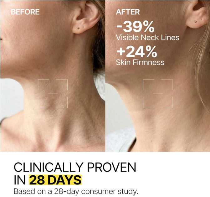 VOLERA™ NeckLift Roller Cream