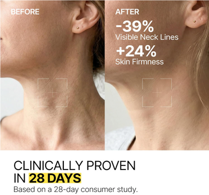 VOLERA™ NeckLift Roller Cream